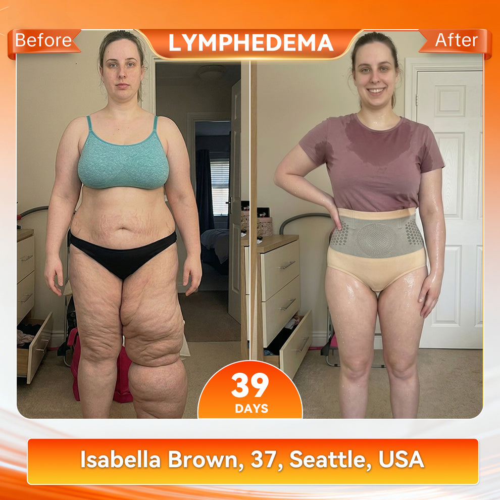 🔥 LAST DAY SALE-80% OFF | 𝐏𝐚𝐢𝐝𝐮𝐢𝐬® 𝐌𝐨𝐫𝐢𝐧𝐠𝐚 & 𝐁𝐞𝐫𝐛𝐞𝐫𝐢𝐧𝐞 4‑In‑1 Micro‑Particle Sculpting & Fat‑Burn Shorts