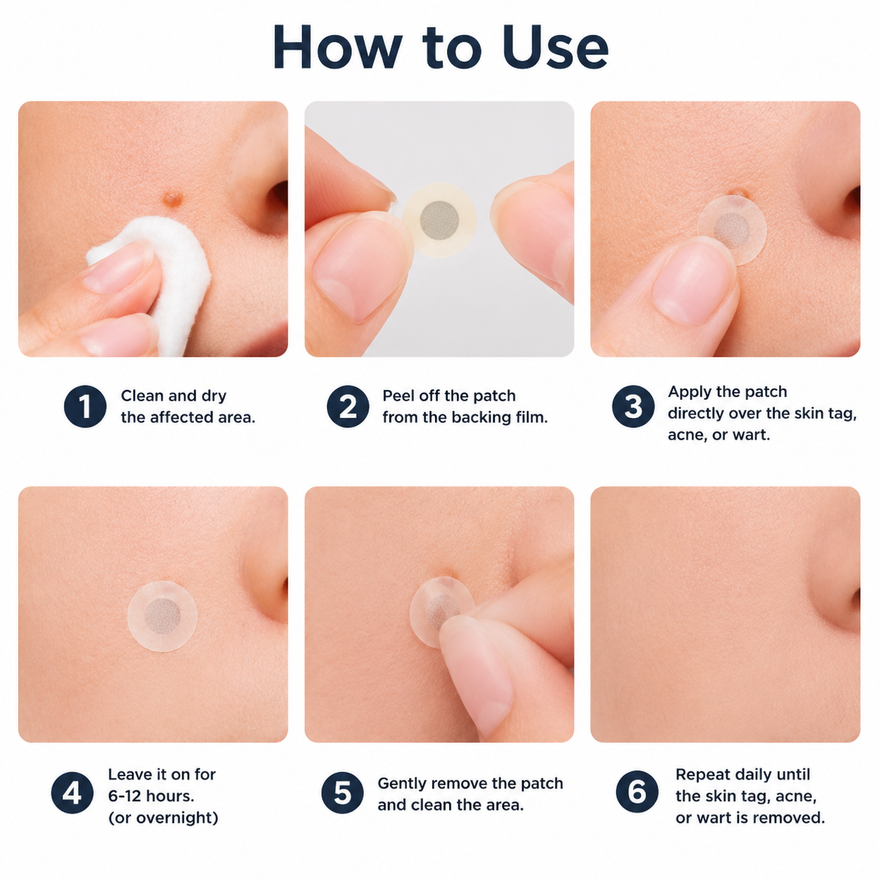 🔥 LAST DAY SALE-80% OFF✨Curalona®2-in-1 Microneedle & Hydrocolloid Patch🍀| Removes Raised Moles, Acne, Flat Warts & Skin Tags | Helps Improve Wrinkles, Scars & Blemishes | Invisible Patches for Face & Body