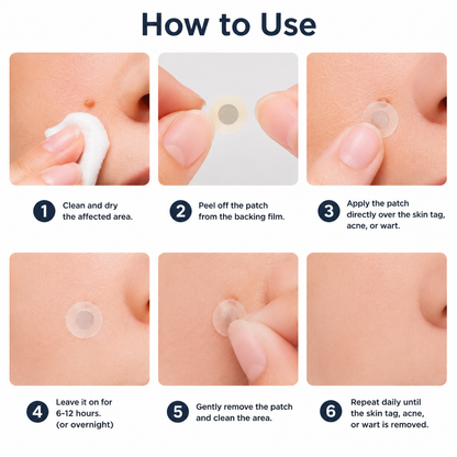 🔥 LAST DAY SALE-80% OFF✨Curalona®2-in-1 Microneedle & Hydrocolloid Patch🍀| Removes Raised Moles, Acne, Flat Warts & Skin Tags | Helps Improve Wrinkles, Scars & Blemishes | Invisible Patches for Face & Body