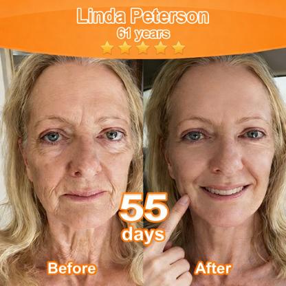 Purelora® Stem Cell Extract EGF and Copper Peptide Revitalizing Essence Cream (deeply activates the skin's internal regeneration, makes the skin firmer and smoother)