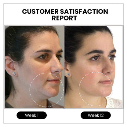 (🔥 LAST DAY SALE-80% OFF)👩‍⚕️💎Czticle® Histone Magnetology Lymphvity Germanium Earrings